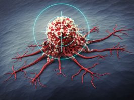 Oncologieverpleegkundige neemt na 17 jaar ontslag om de waarheid over kanker te verkondigen